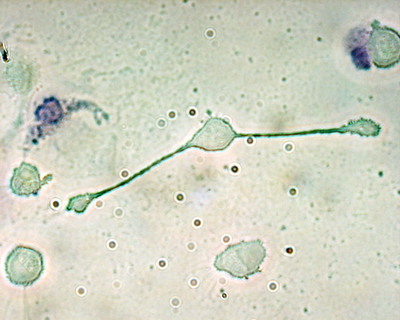 2-3Macrophage.jpg